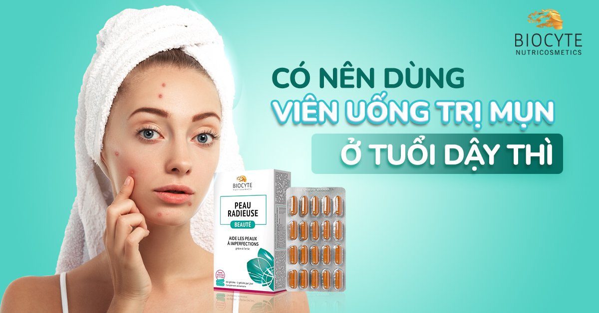 Có nên dùng viên uống trị mụn ở tuổi dậy thì?